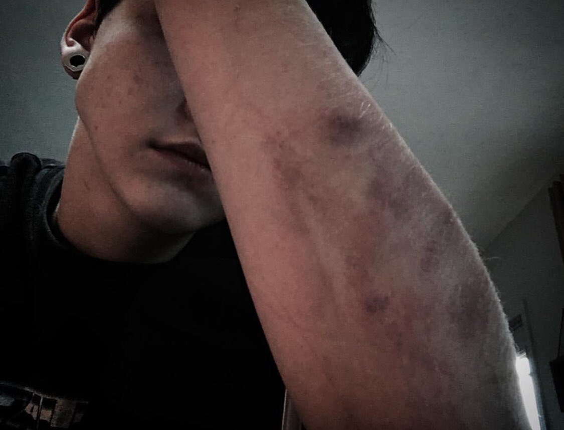 andrOxygen's tweet photo. A L E R T A L E R T 

SHILOH GOT HURT https://t.co/y11GaiYgYn