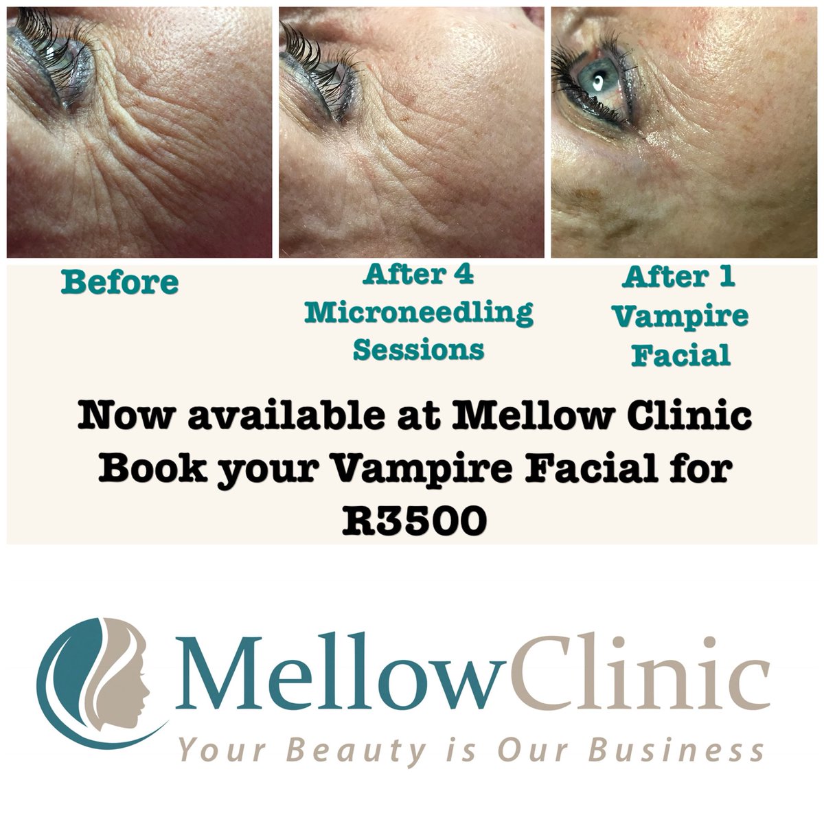 mellowclinic's tweet photo. https://t.co/bhgHhwbvzq