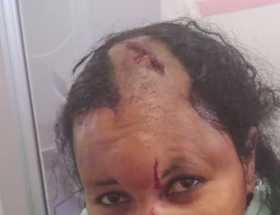 RobertAlai's tweet photo. KRA employee Said Mohamed Osman will one day kill his wife. This is brutality which Akila Police Station has refused to stop. https://t.co/jEKGs8AJgk https://t.co/Sl7zkfF6Sf