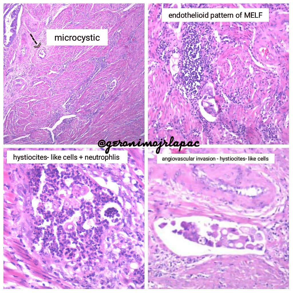 Gerônimo Jr. tweet media