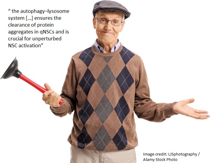 NatRevMCB's tweet image. #ResearchHighlight #Ageing: Proteins clog #neuralstemcell activation go.nature.com/2vaDE7W #autophagy #proteostasis #lysosome #adultstemcells @sciencemagazine @BrunetLab