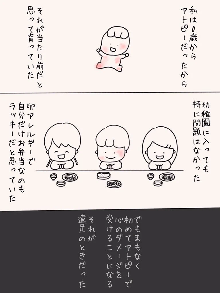 周囲の理解も大事…！アトピー性皮膚炎のツラさってこんな感じ