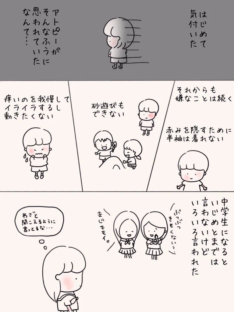 周囲の理解も大事…！アトピー性皮膚炎のツラさってこんな感じ