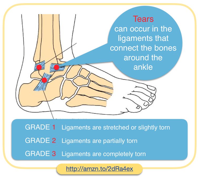 #anklepain injuries infographic