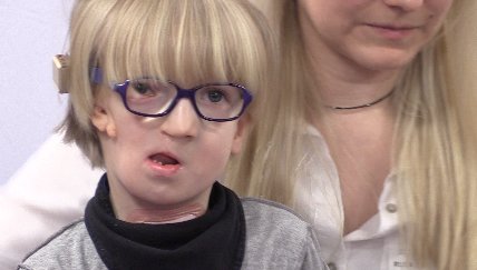 Meet 5-year-old Rokas. He has a condition similar to the boy in @WonderTheMovie and doctors at @NorthwellHealth are helping him live a more normal life. Story on @FiOS1News_LI. #GoldenharSyndrome