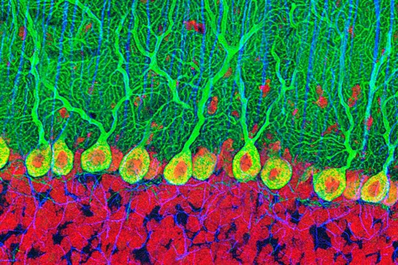 jratey's tweet photo. "Old people can produce as many new #brain cells as teenagers" #KeepMoving #PhysEd https://t.co/mftGd19PJc https://t.co/PJ0ibes08F