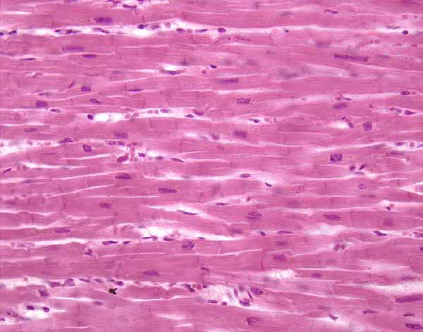 What is the type of this tissue and where we can find it ? #testyourself