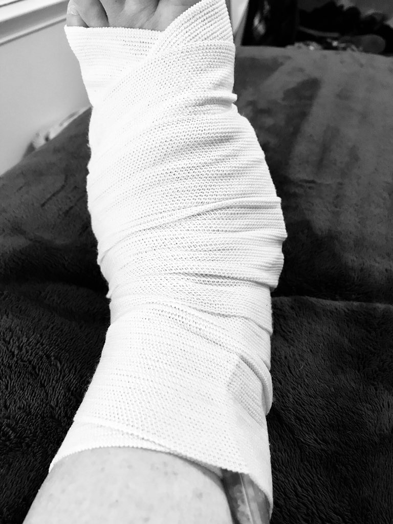 allyb1013's tweet photo. How do you spell relief... ICE PACK!! #thankshubby #PlantarFasciitis #halfmarathontraining #rnrnashville https://t.co/ja3hfdaR5N
