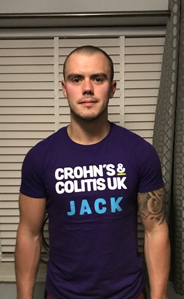 CrohnsColitisFR's tweet photo. 🏃‍♂️📚💜 The amazing @jackgowar is running the London Marathon in less than two weeks! Join us in congratulating him for raising a fantastic £2000 by hosting a pub quiz AND shaving his head! 🏃‍♂️📚💜 https://t.co/cdKEfOC6NW