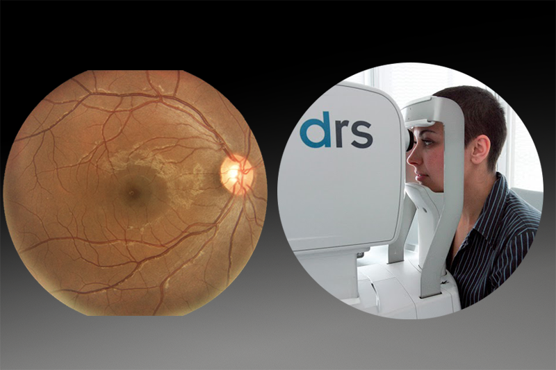 HS_UK's tweet photo. You can capture an automated high-quality image in just 30 secs with a DRS retinal camera!  Visit stand F32 at #Optrafair and see for yourself.  #Optrafair2018 #DRS #Retinalcamera  https://t.co/FD1LHAxRTu https://t.co/LDh3ucFfe9