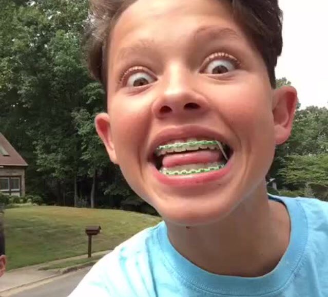 WakyAnd's tweet photo. Remember when this fatty had braces🤪🤓😁 #chaostheory https://t.co/KRQSpNSHWU