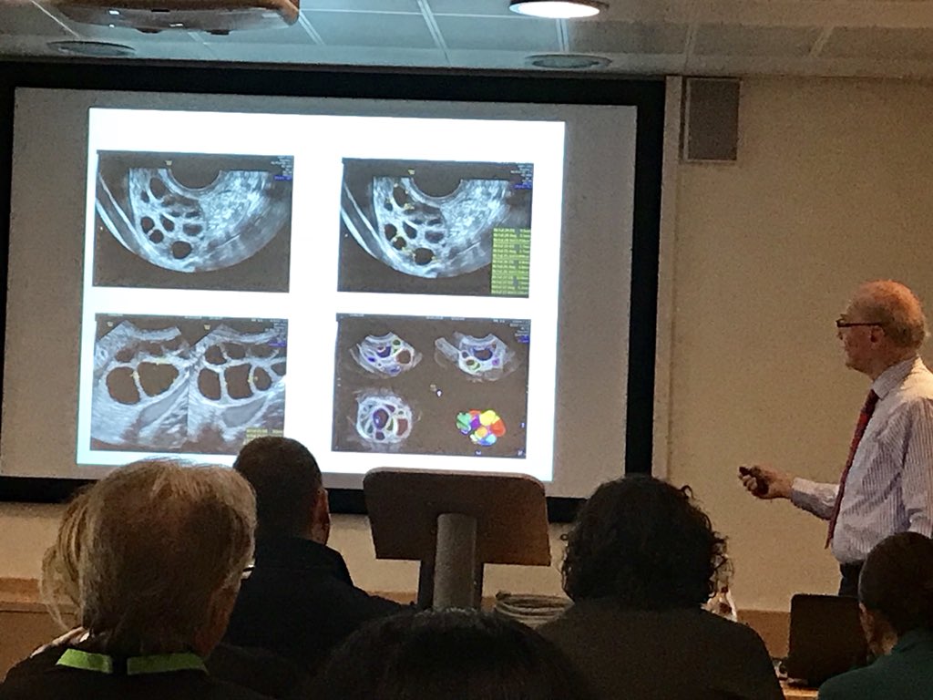 Professor Stuart Campbell, our director of ultrasound doing a workshop on TV ultrasound! <a href="/ISMAAR18/">ISMAAR</a> #IVF #fertility #womenshealth