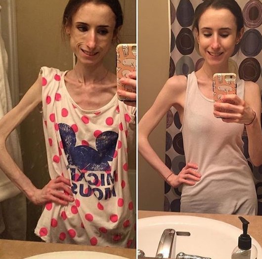 HealthIr's tweet image. Physical fitness is not only one of the most important keys to a healthy body, it is the basis of dynamic and creative intellectual activity. #fitness #health #fit #fitnessmodel #fitnessmodels #fitnessaddict #workout #healthy #healthyandfit #bodybuilding #cardio #gym #motivation