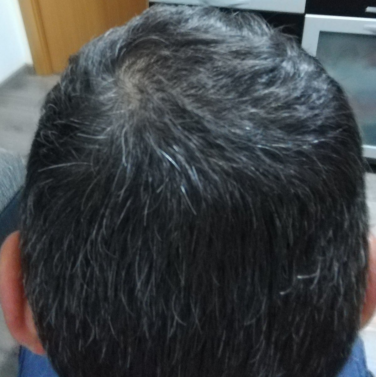 hoommerr73's tweet photo. #InsidersControlGX dia 0
No decías que no tenía canas? @danisoriano70 😂 https://t.co/0buWYTJsoB