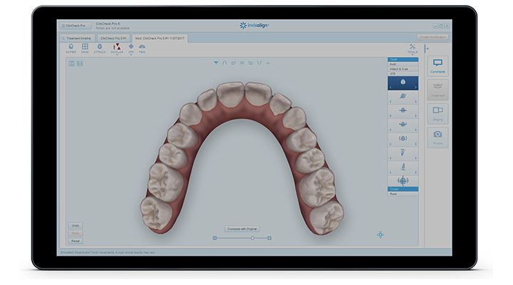ImpressionsDen3's tweet photo. Feel the Invisalign difference. A modern, fully digitized experience to help you get the smile you want, the way you want.
https://t.co/3CNGzoExpc
#Invisalign #InvisalignSmile #InvisalignDifference #InvisalignBahamas #TopDentist #CosmeticDentist #ImpressionsDental #Nassau https://t.co/SU0x9BYAnk