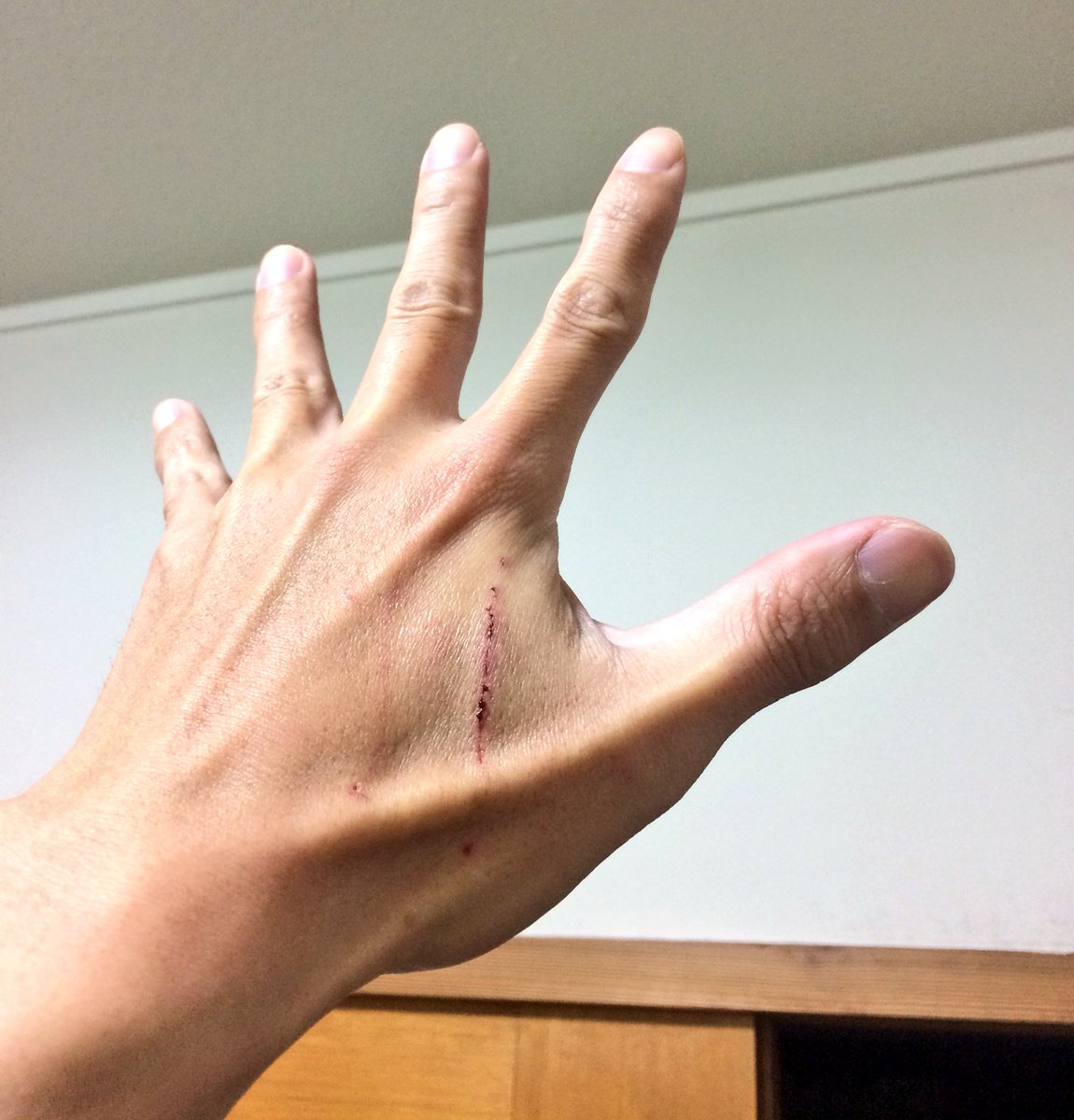 青木まさと Auf Twitter 性欲の獣に結構かっこいい傷をつけていただきました T Co Lntkjpy5ai Twitter