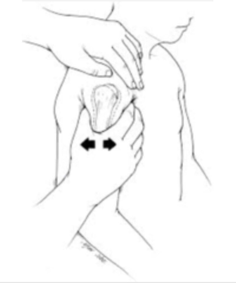 #ReiffReport on Twitter: "Anterior instability of the shoulder can be