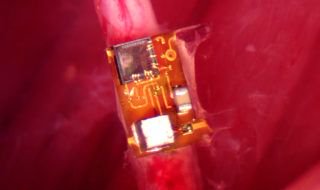 UCBerkeleyNeuro's tweet photo. The Maharbiz and Carmena Labs presented the smallest implant for nerve simulation that could revolutionize healthcare at the IEEE Custom Integrated Circuits Conference in San Diego. #StimDust https://t.co/p3C6qU3awl https://t.co/CYAo2pJtyq