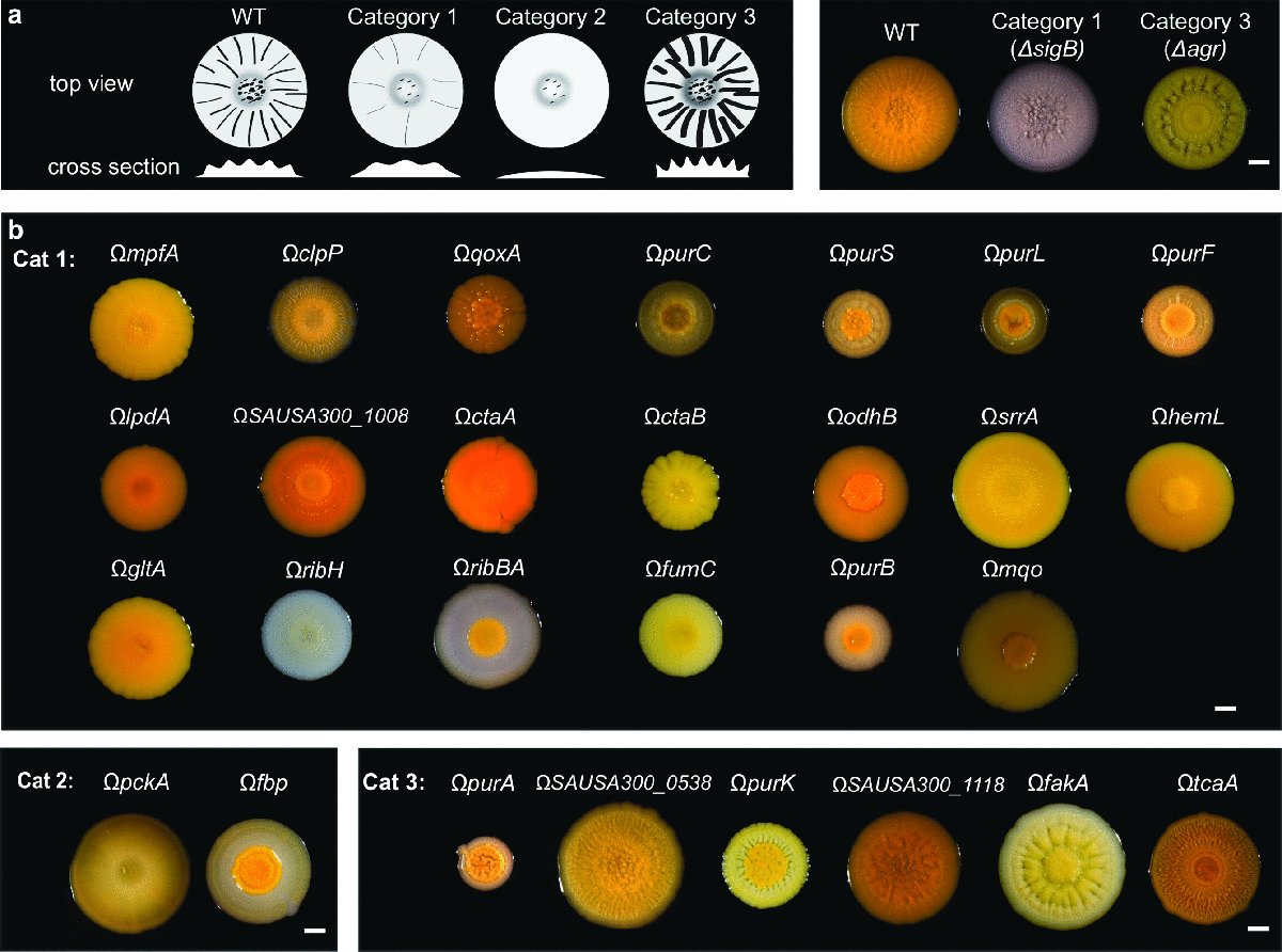 joseramosvivas's tweet photo. Esta sí que es una colección de colonias de #Staphilococcus aureus #bacterias
#superbacterias
https://t.co/oYJJYrxx0O https://t.co/DuXf2ARpyq