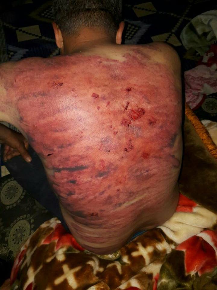 AzadiRojava's tweet photo. Erdogans Jihadis from the group Jaysh al Sharqiya Tortured a man from Cindirese this badly after he asked the filth to leave his home and return it to him. This is how #NATO Turkey 'secures its borders'. #TurkishWarCrimes #WeAreNATO https://t.co/tpyXHAdNCC