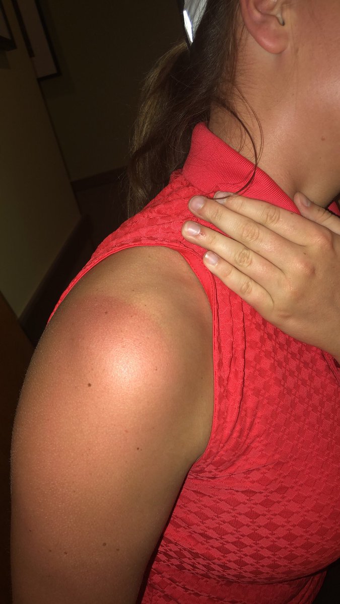 NSGirlsGolf's tweet photo. Life of a golfer 🤦🏽‍♀️😅😂 https://t.co/1s4bRXLa7V