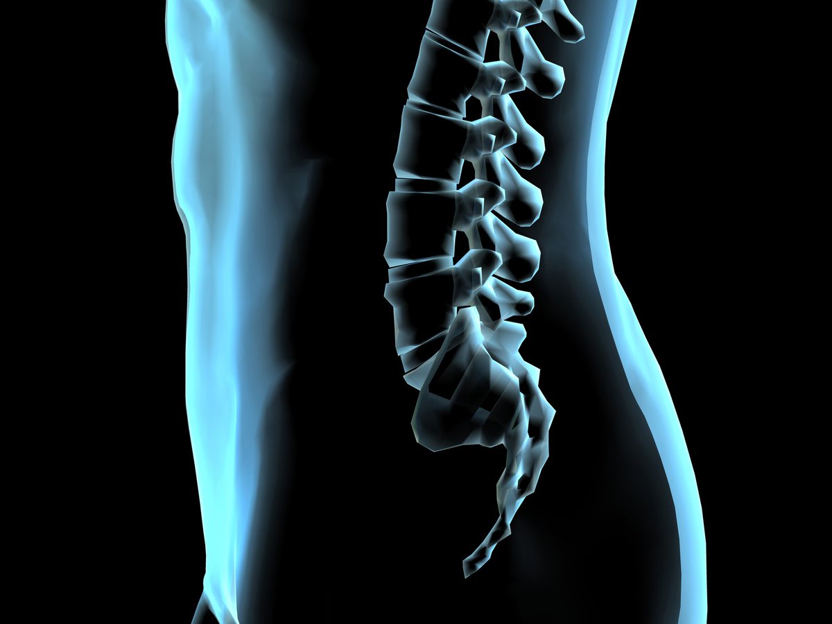 5 ways to find support When dealing with unpredictable symptoms like joint pain and stiffness: trib.al/w9sopFW
