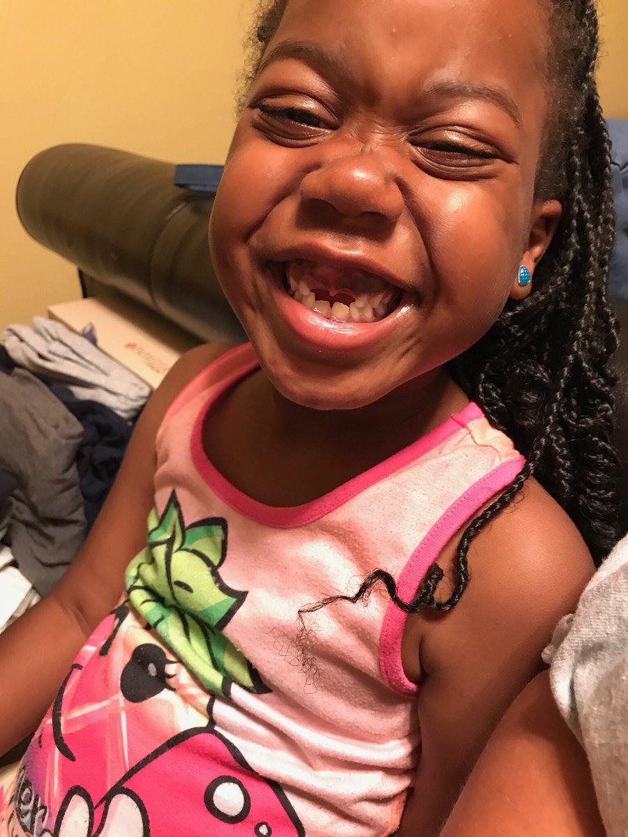 GatorGrad929's tweet image. #SnaggleTooth #NoTeeth