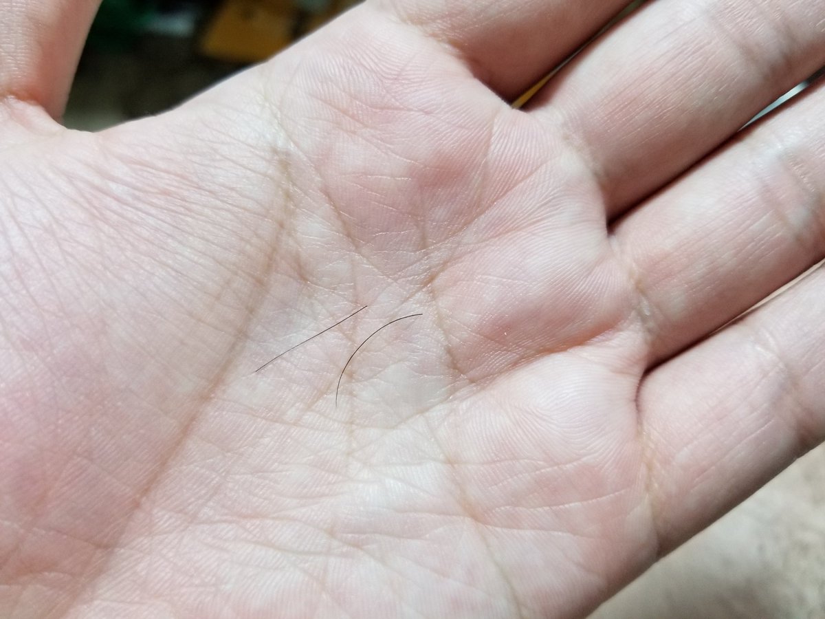 あにぴよ Na Twitteru ふとした瞬間に耳の中からゴポゴポッ って音がするのがかれこれ数ヶ月続いていて 気になって仕方なかったので耳 スコープ T Co Ki1tfo4yvd 買って覗いてみたら 髪の毛みたいなものが2本鼓膜の所につっかえてた 四苦八苦しながら あにぴよ Na Twitteru ふとした瞬間に耳の中からゴポゴポッ って音がするのがかれこれ数ヶ月続いていて 気になって仕方なかったので耳 スコープ T Co Ki1tfo4yvd 買って覗いてみたら 髪の毛みたいなものが2本鼓膜の所につっかえてた 四苦八苦しながら
