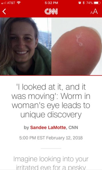 HealthIr's tweet image. 'I looked at it, and it was moving': Worm in woman's eye leads to unique discovery
 #health #fit  #healthy #healthyandfit #bodybuilding #cardio  #photooftheday #instahealth #healthychoices  #active #strong #instagood #determination #lifestyle #diet #worm #gethealthy #eye