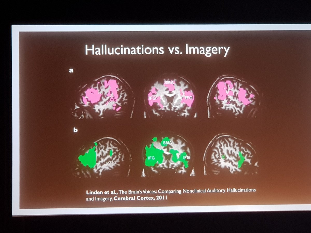 Rohit_Chandra's tweet photo. Translatie neuroimaging in de psychiatrie van David Linden. Innovatie in de neuroimaging. 

Bovenste beeldvorming horen bij een patiënt met hallucinatie.

#NVvP2018 https://t.co/fhfnf4cGsh