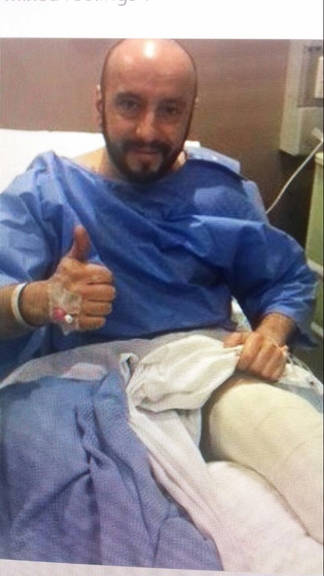 DavidDobber1's tweet photo. @FacialMac facial @dumbfrank has been in the wars https://t.co/IbswrfUp8h
