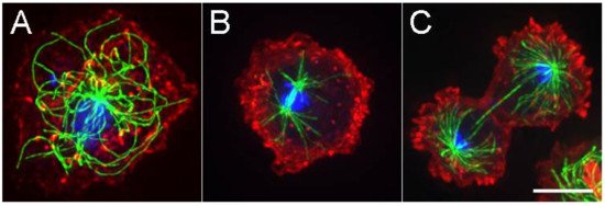 MDPIOpenAccess's tweet image. Centrosome Positioning in Dictyostelium: Moving beyond Microtubule Tip Dynamics sci.fo/4q4 #Centrosome #Microtubule #Dynein #Kinesin