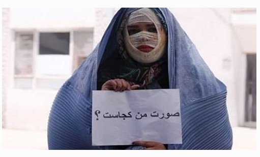 Metanat8's tweet image. #إيران: رش الحامض على امرأة شابة بمدينة تبريز 
👇👇👇
🔴أين وجهي؟

mojahedin.org/newsar/92092/%…