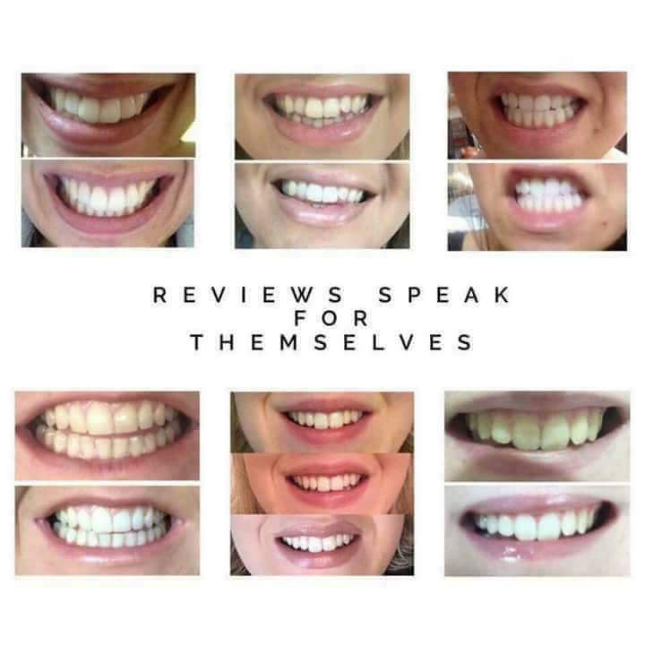 🚨ALERT🚨 CALLING ON ALL SMOKERS, WINERS🍷 & CAFFEINE DRINKERS ☕ ❓Whiter Teeth❓ ❓Stain Remover❓ Your answer is right here! ✔Removes stains ✔Eliminates plaque build up ✔No peroxide ✔Non abrasive A SMILE IS THE PRETTIEST THING YOU CAN WEAR!!! 📩 Inbox 4 detail