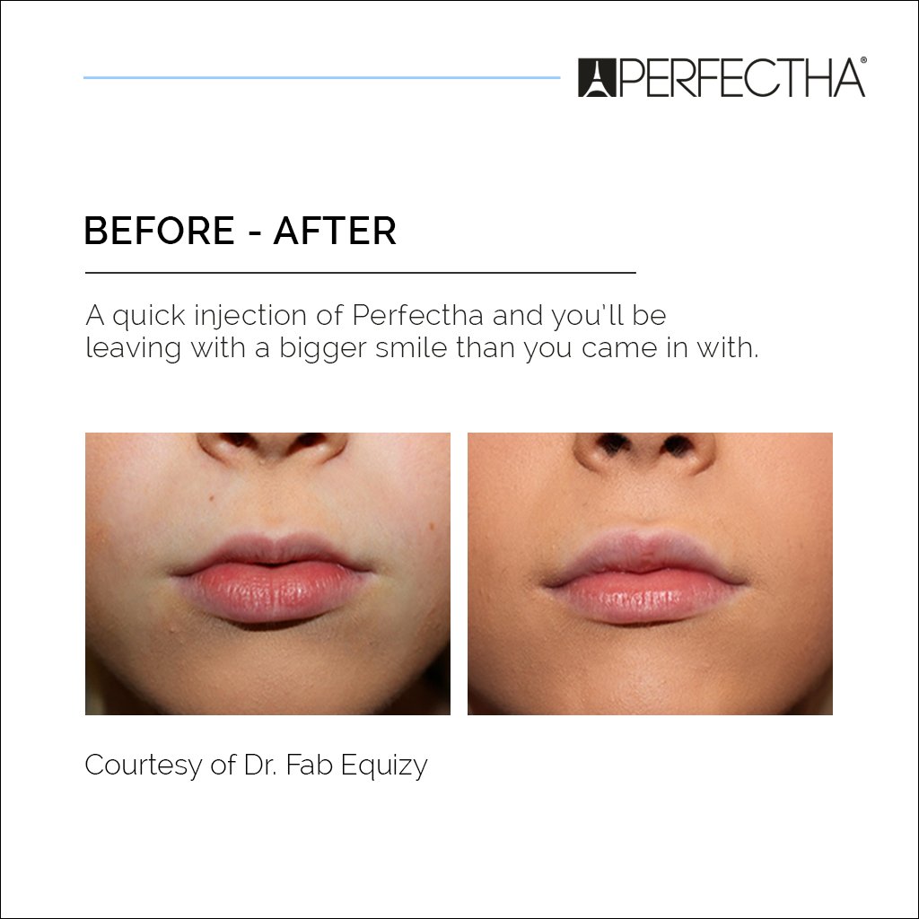 Perfectha Global tweet media