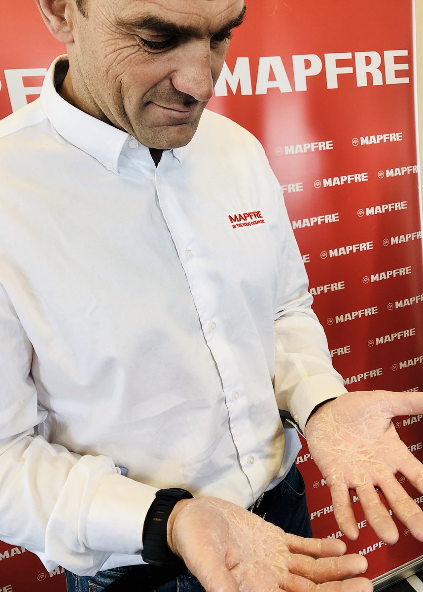 ✋Las manos de un campeón🤚. Acercad la foto ¿veis las manos de Xabi? La regata más dura del mundo deja tb estas huellas, unas manos llenas de ampollas y heridas por el permanente frío, agua,... #fuerza #resistencia #liderazgo #VamosMAPFRE <a href="/desafioMAPFRE/">Desafío MAPFRE</a> ⬇️