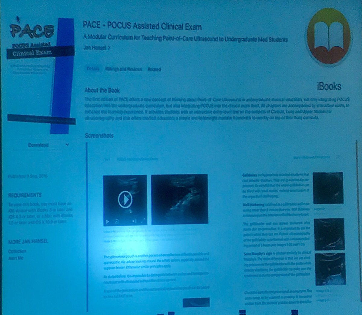 danielmoro10's tweet photo. The Slovenian experience implementing POCUS in Medical Schools with @gregorprosen #WINFOCUS18 https://t.co/Ml0RKwZD1S