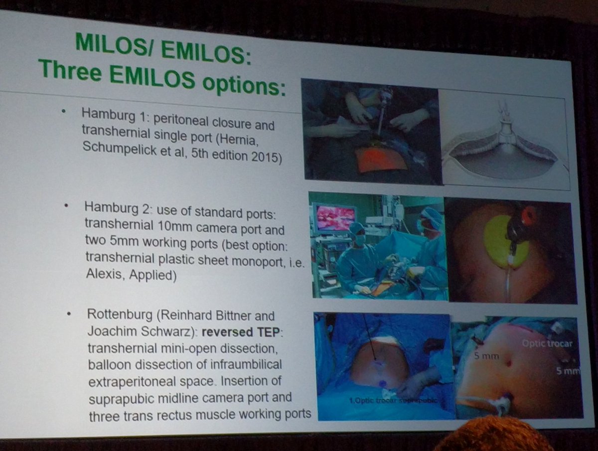 TuncaySARI's tweet photo. Retweeted Vamsi V. Alli (@VamsiAlli):
Dr. Reinpold discussing #MILOS & #eMILOS approach to MIS hernia repair.
▪️Cost effective
▪️Low complications
▪️Good outcomes
▪️Favorable cosmetics
#SAGES2018 https://t.co/4rz0HU0Hkm