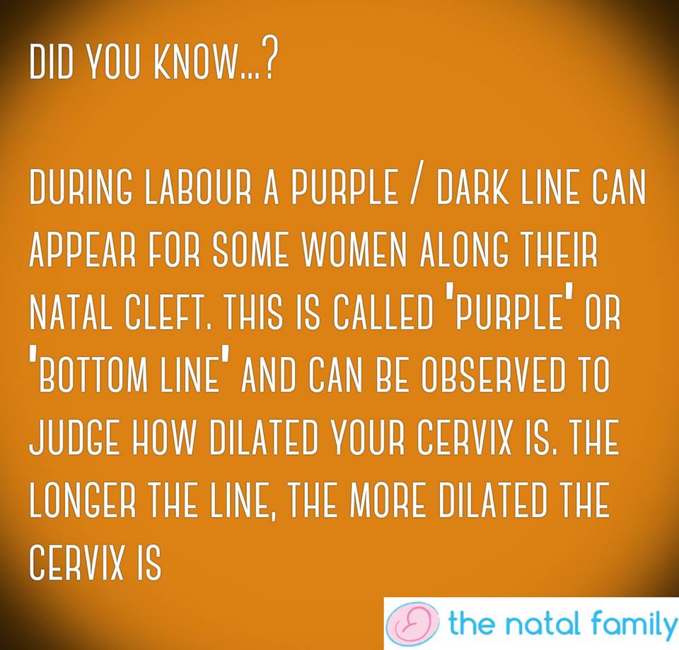 MummyNatal's tweet photo. #FridayFact Did you know about the 'purple line'? And did you know that if you have one it can be a way for your midwife to check how dilated your cervix is during labour, instead of a vaginal examination? https://t.co/WAObxZ1GlL