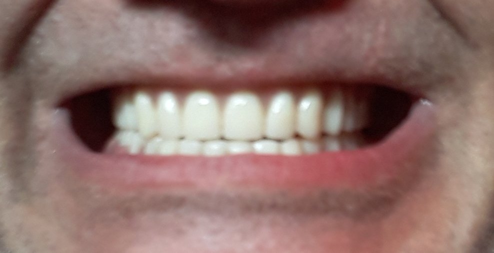 MattyTheCook's tweet image. Money is metric.