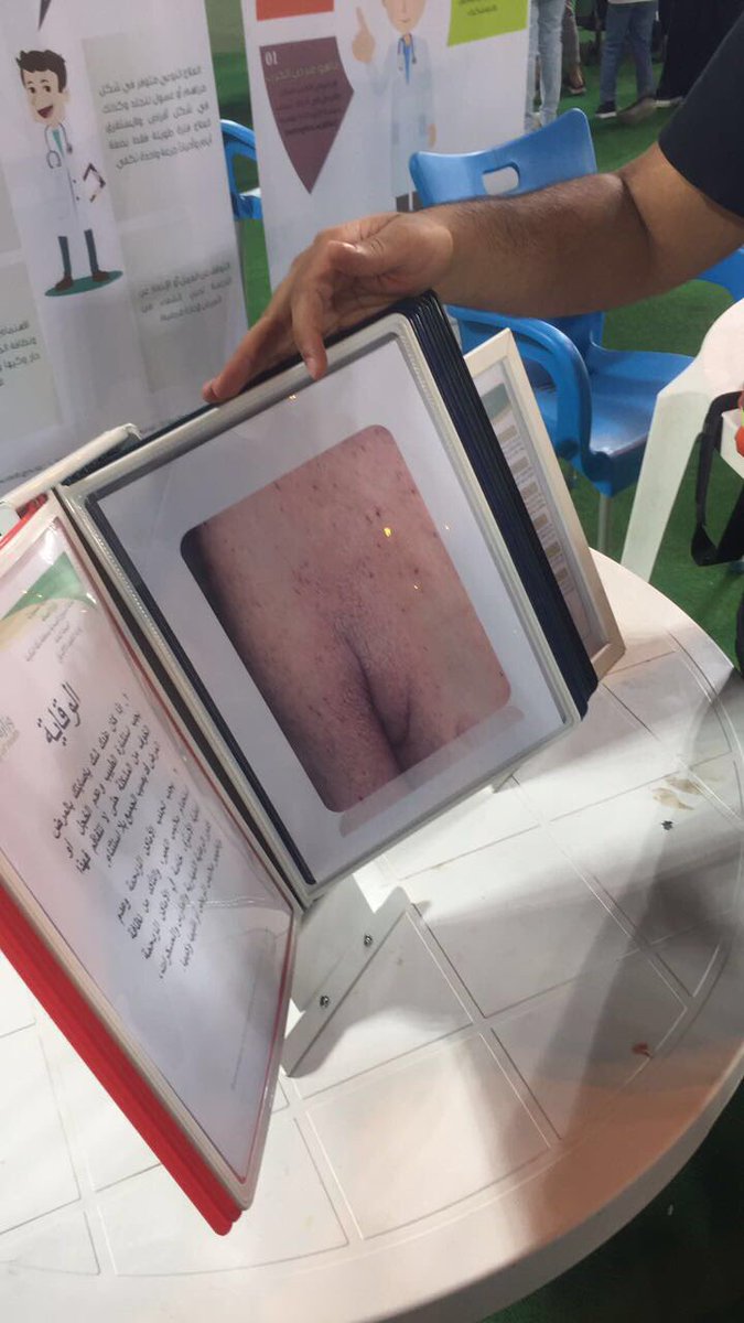 lightmed1's tweet photo. ومع انتشار وباء " الجرب " شارك فريق لايت الحضور بالمعلومات الصحيحة وطرق العلاج تجاه المرض في مهرجان الربيع ٢ في الشرائع ♥️✨ #وزارة_الصحة #light_team @SaudiMOH https://t.co/GSJyUglOGZ