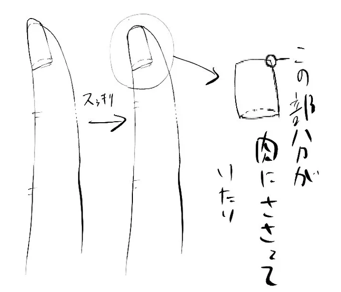 爪切った後めっちゃ痛い… 