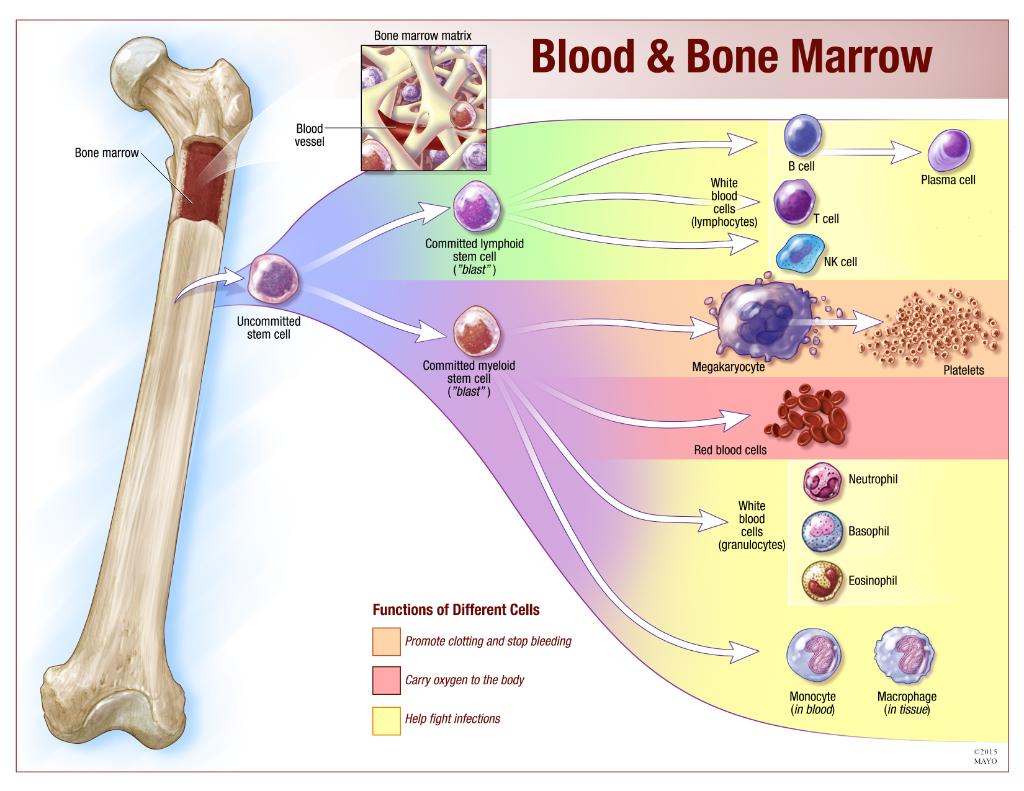 Bone Marrow Transplant Stem Cell bone-marrow-transplant-stem-cell