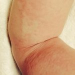 アレルギー反応に注意 刺身のタンポポは醤油に浸して食べると一味違う風味になる というテレビの情報を鵜呑みにしたら全身が蕁麻疹に Togetter アレルギー反応に注意 刺身のタンポポは醤油に浸して食べると一味違う風味になる というテレビの情報を鵜呑みにしたら全身が蕁麻疹に Togetter
