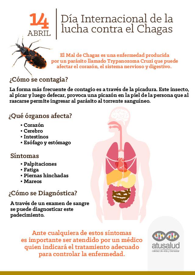 esófago de chagas esófago de chagas