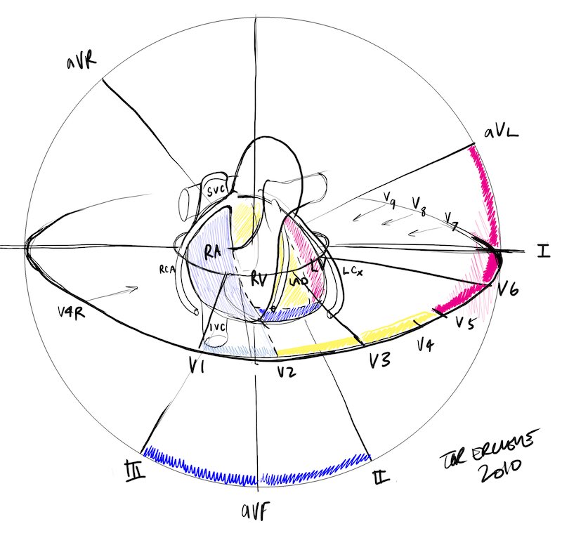 MSAg003's tweet photo. Finally found an excellent visual for MI Localization by Tov Ercleve #graphicdocs #visualmedicine 
 https://t.co/tCpfPhc90B via @sandnsurf https://t.co/MJr9m6JEA8