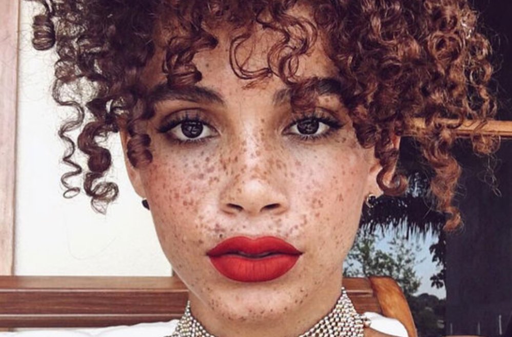 Sport mounth freckles ebony