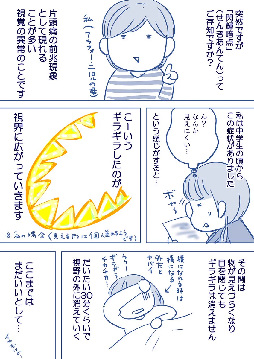 目のチカチカの後に頭痛！閃輝暗点って知ってる？