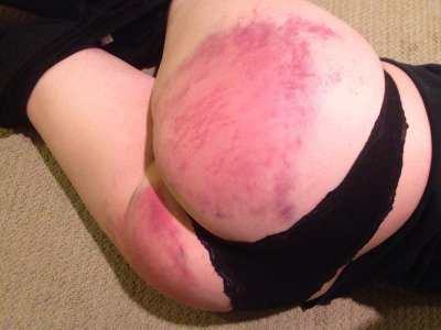 Diesel933's tweet photo. Who likes a good spanking once in a while. To bad shes anonymous. Still show her booty some love  #spanked #CurvyGirlsRock #bdsmlove https://t.co/ECLORcgOoh