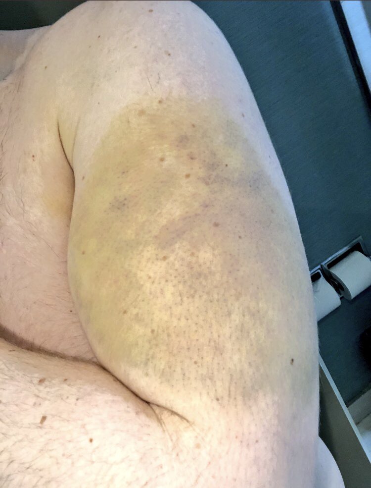 FastBreakLax tweet media